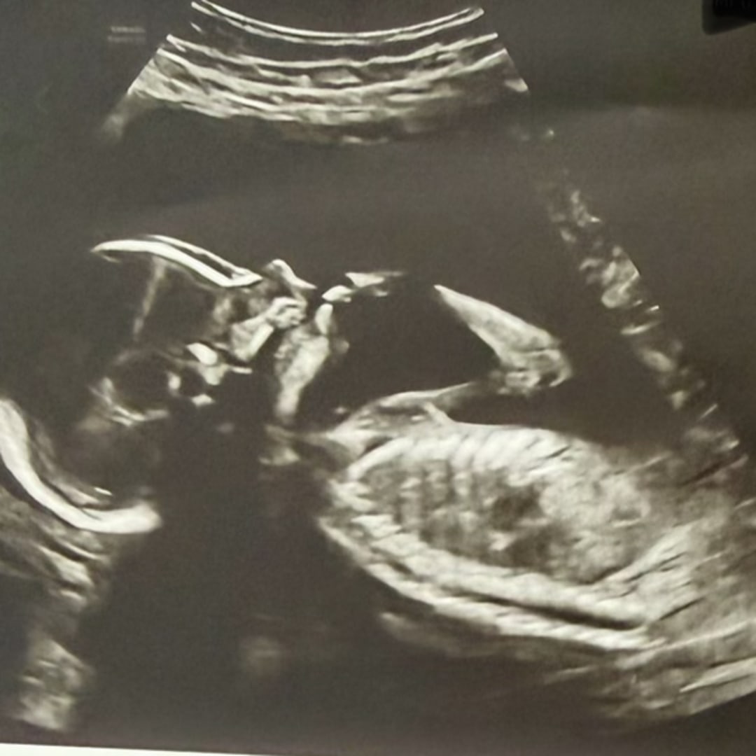 Photo shared by Nicole for their Babylist baby registry.
