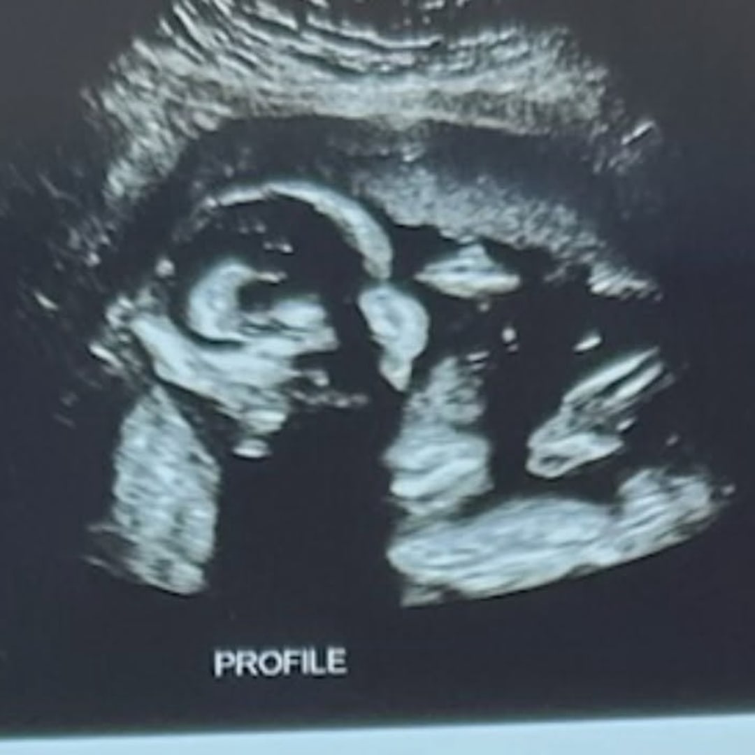 Photo shared by Holly for their Babylist baby registry.