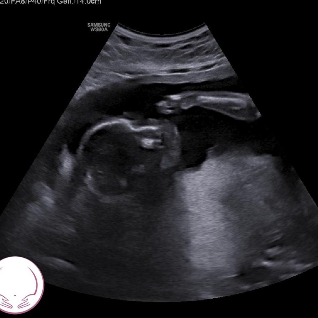 Photo shared by Erika for their Babylist baby registry.