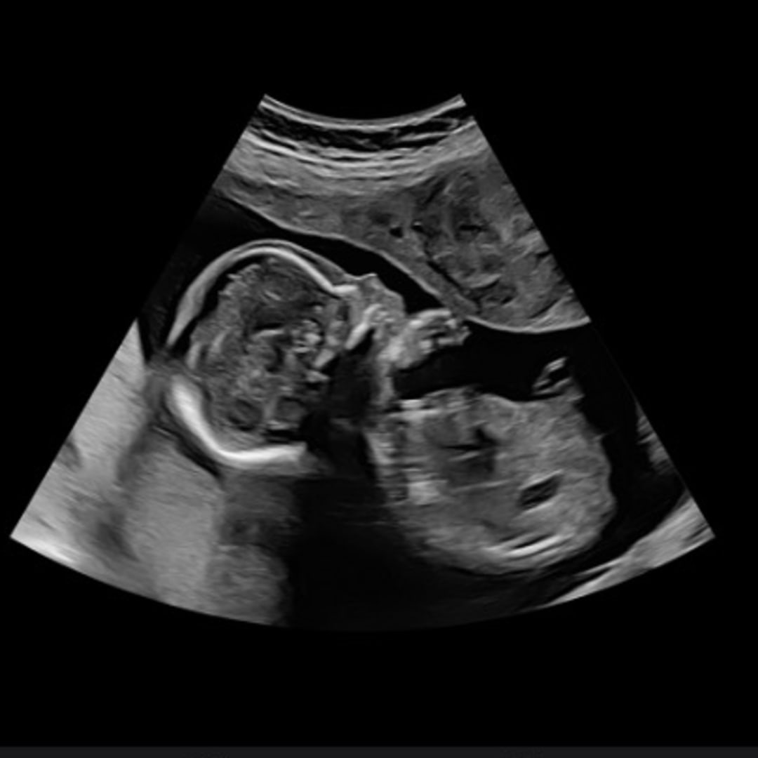 Photo shared by Leia for their Babylist baby registry.