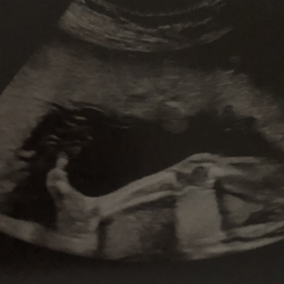 Photo shared by June for their Babylist baby registry.