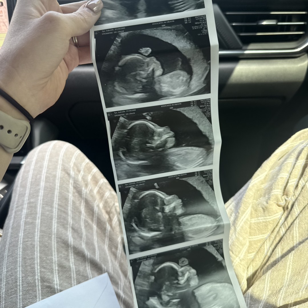 Photo shared by Gabrielle for their Babylist baby registry.