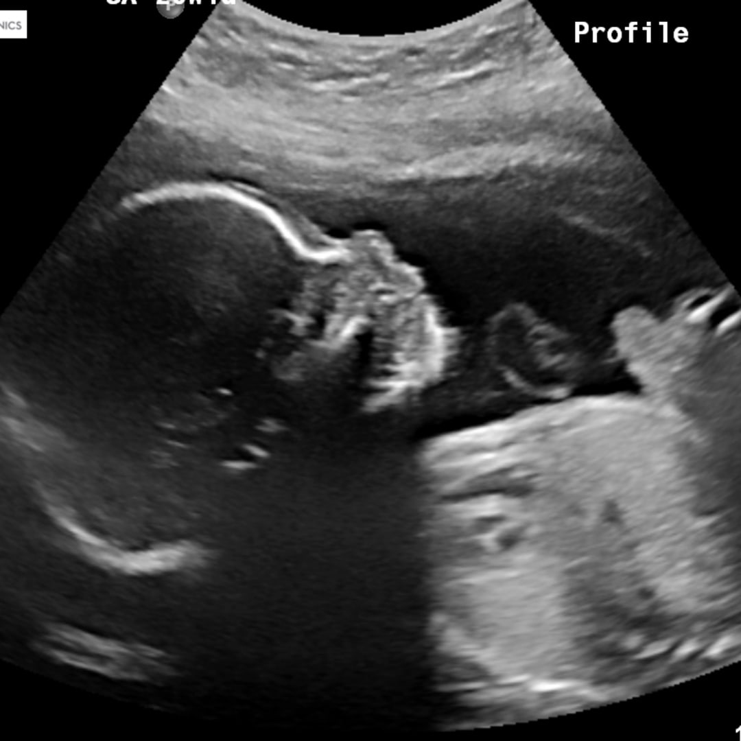 Photo shared by Teigan for their Babylist baby registry.