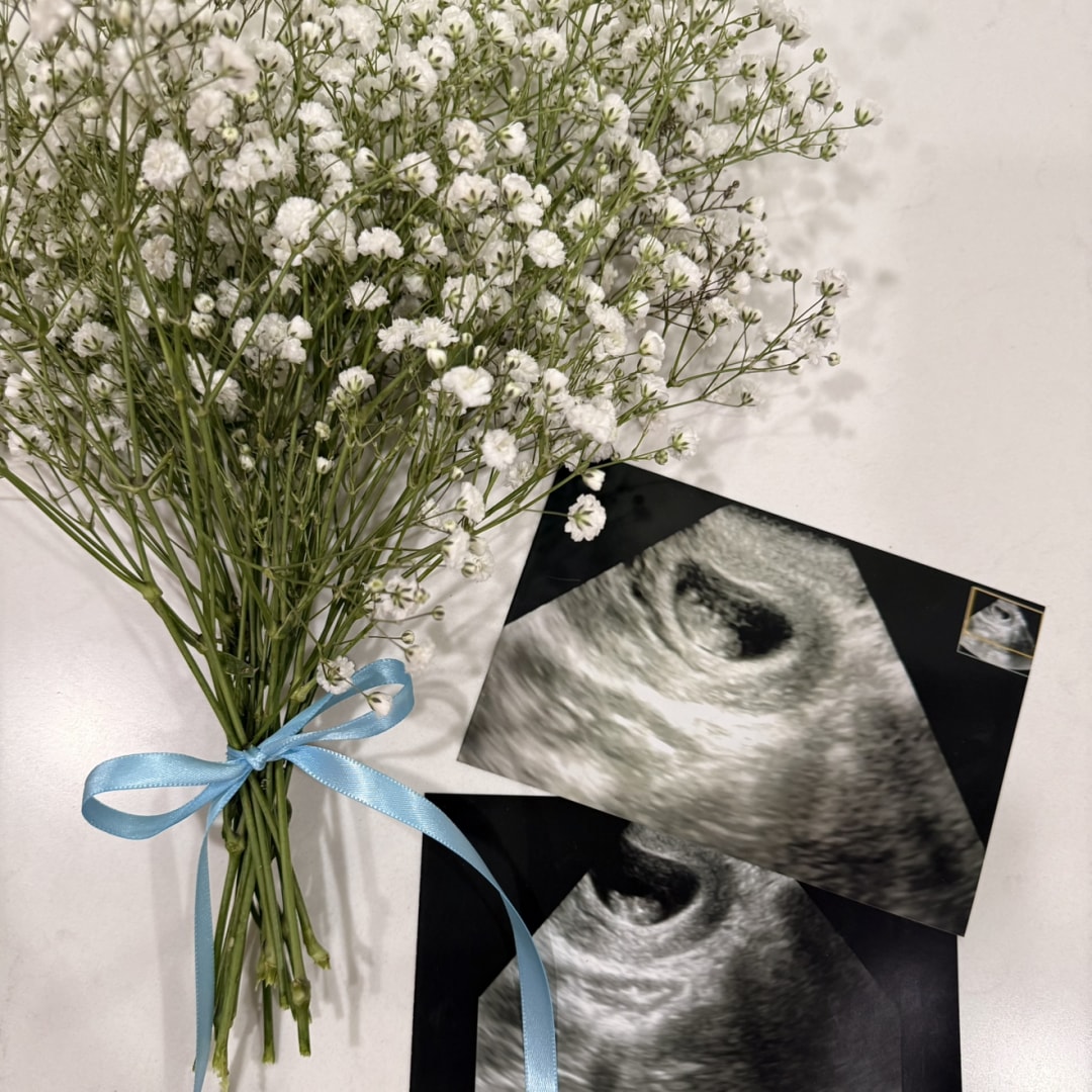 Photo shared by Morgan for their Babylist baby registry.