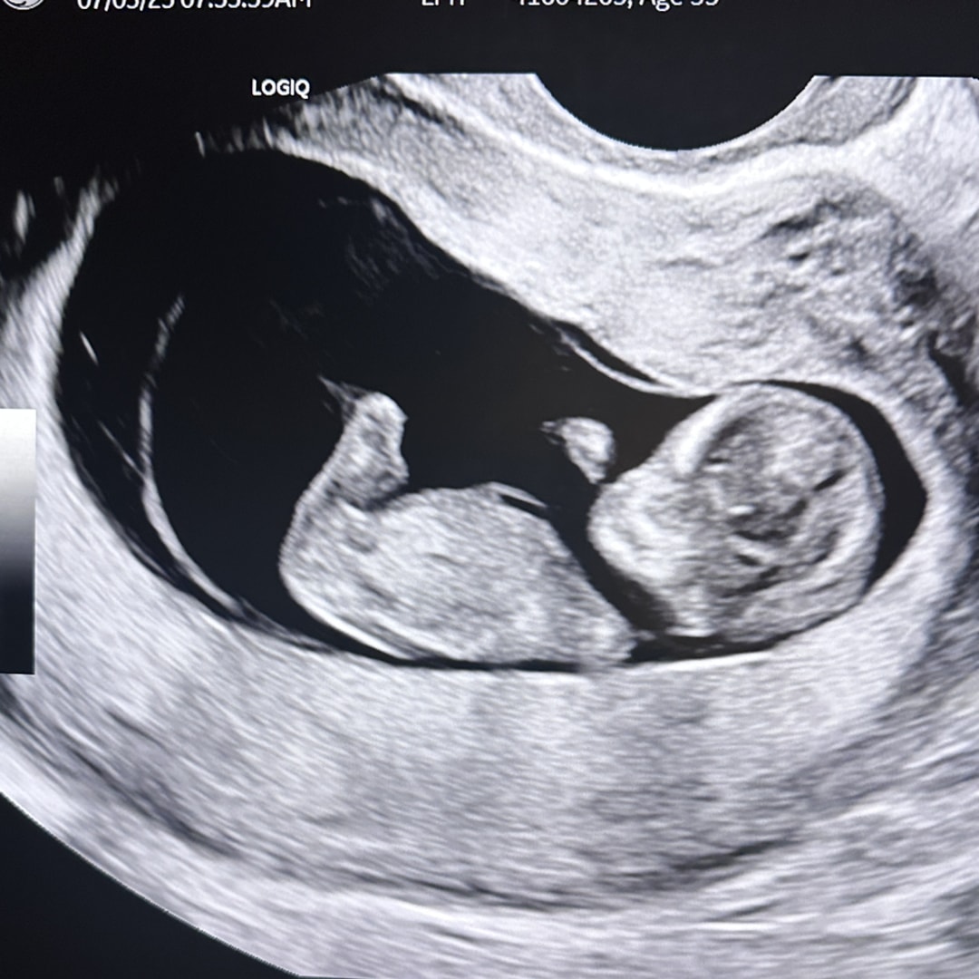Photo shared by Grace Kelly for their Babylist baby registry.