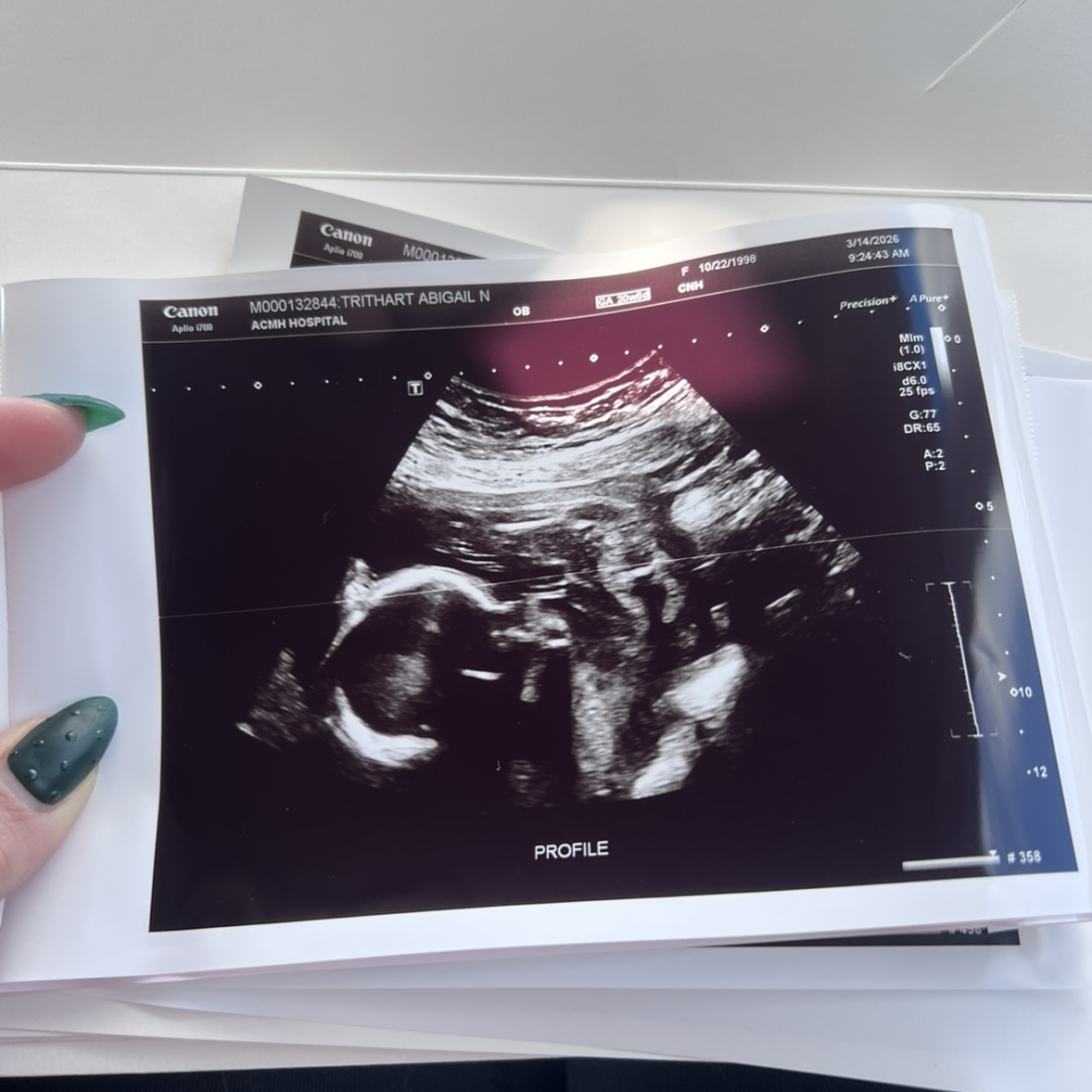 Photo shared by Abigail for their Babylist baby registry.