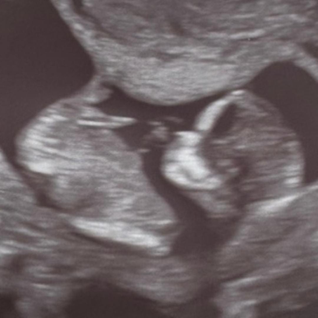 Photo shared by Addison for their Babylist baby registry.