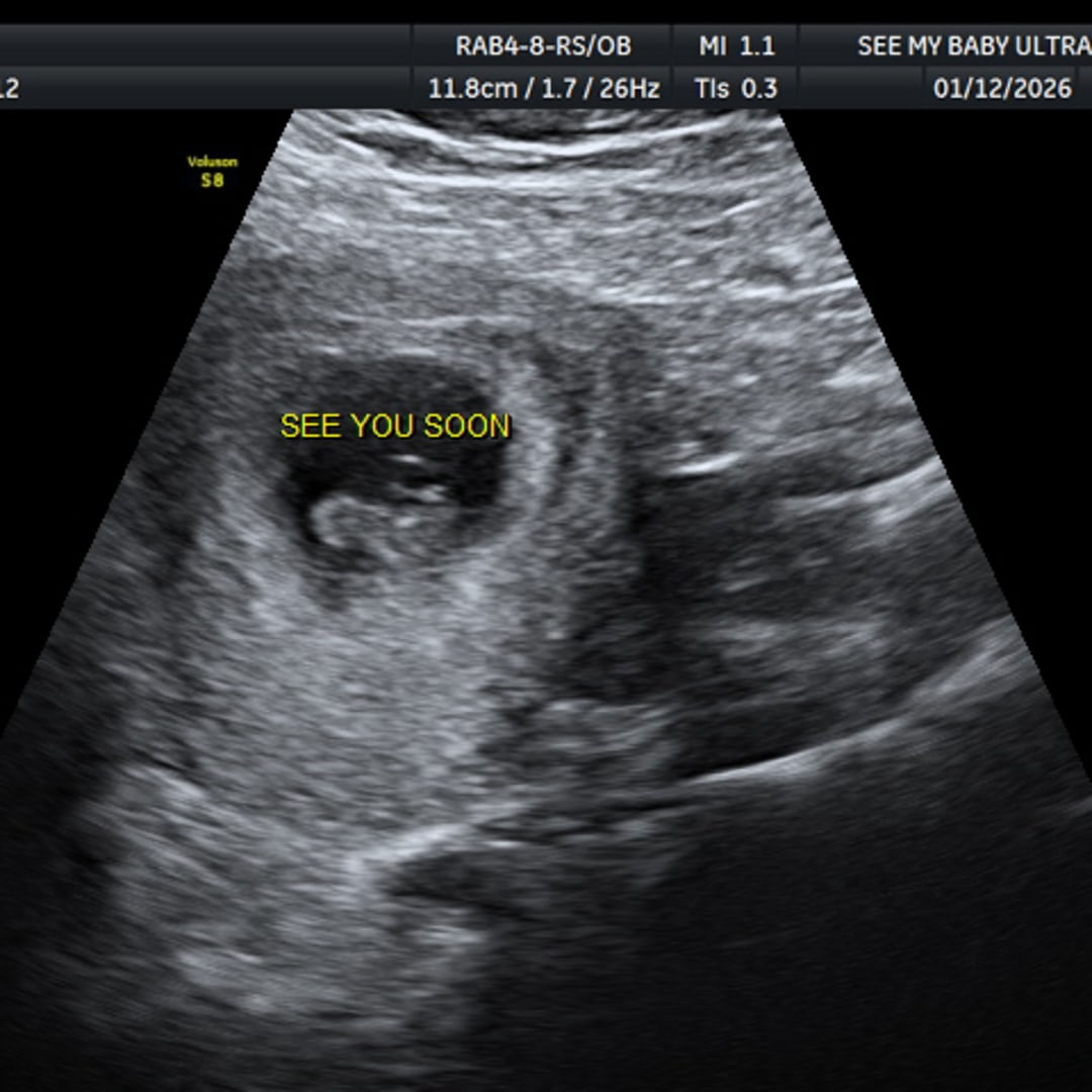 Photo shared by Duvrashka for their Babylist baby registry.