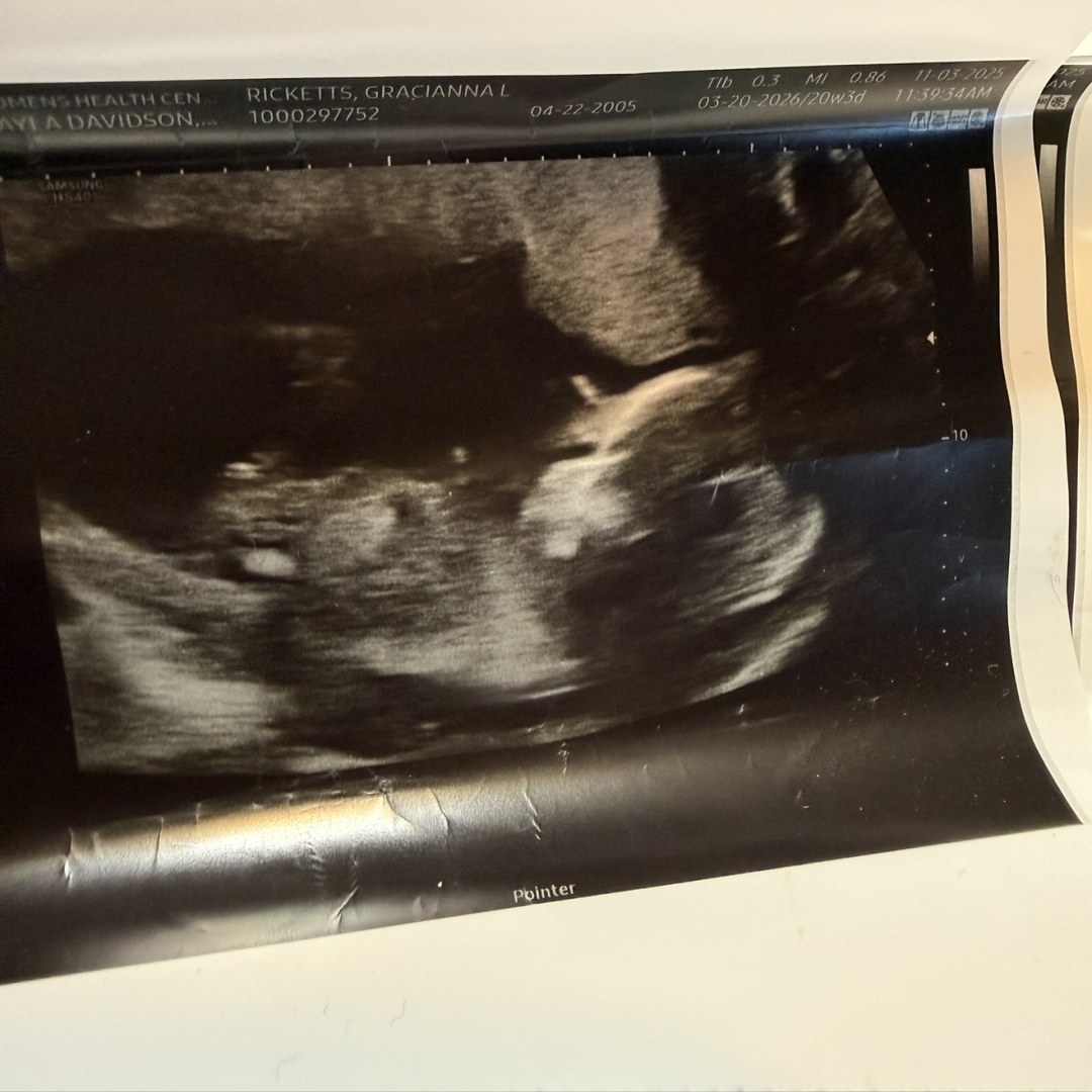 Photo shared by Gracianna for their Babylist baby registry.