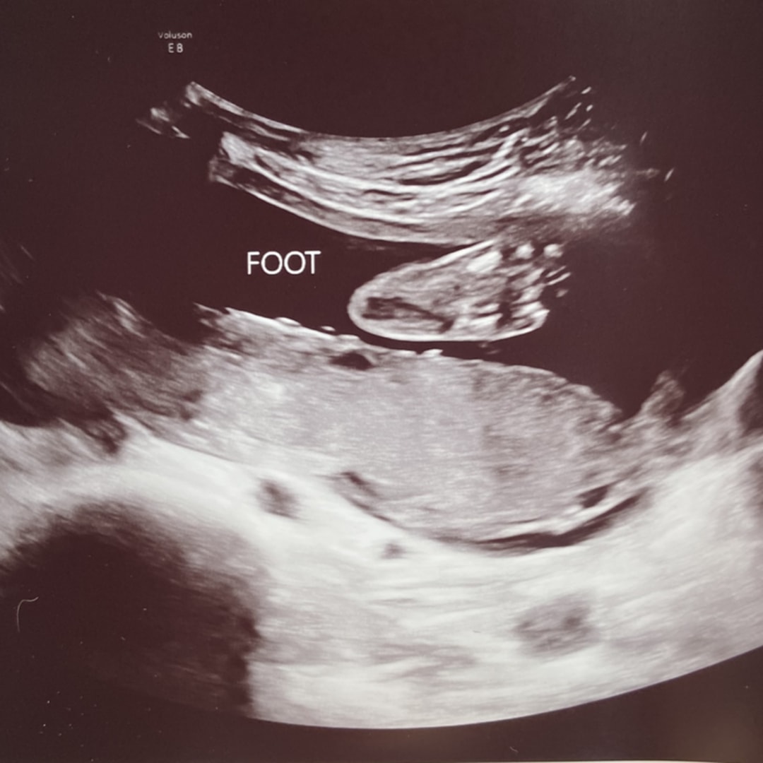 Photo shared by Cassidy for their Babylist baby registry.