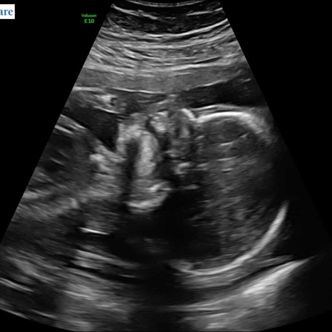 Photo shared by Allie for their Babylist baby registry.