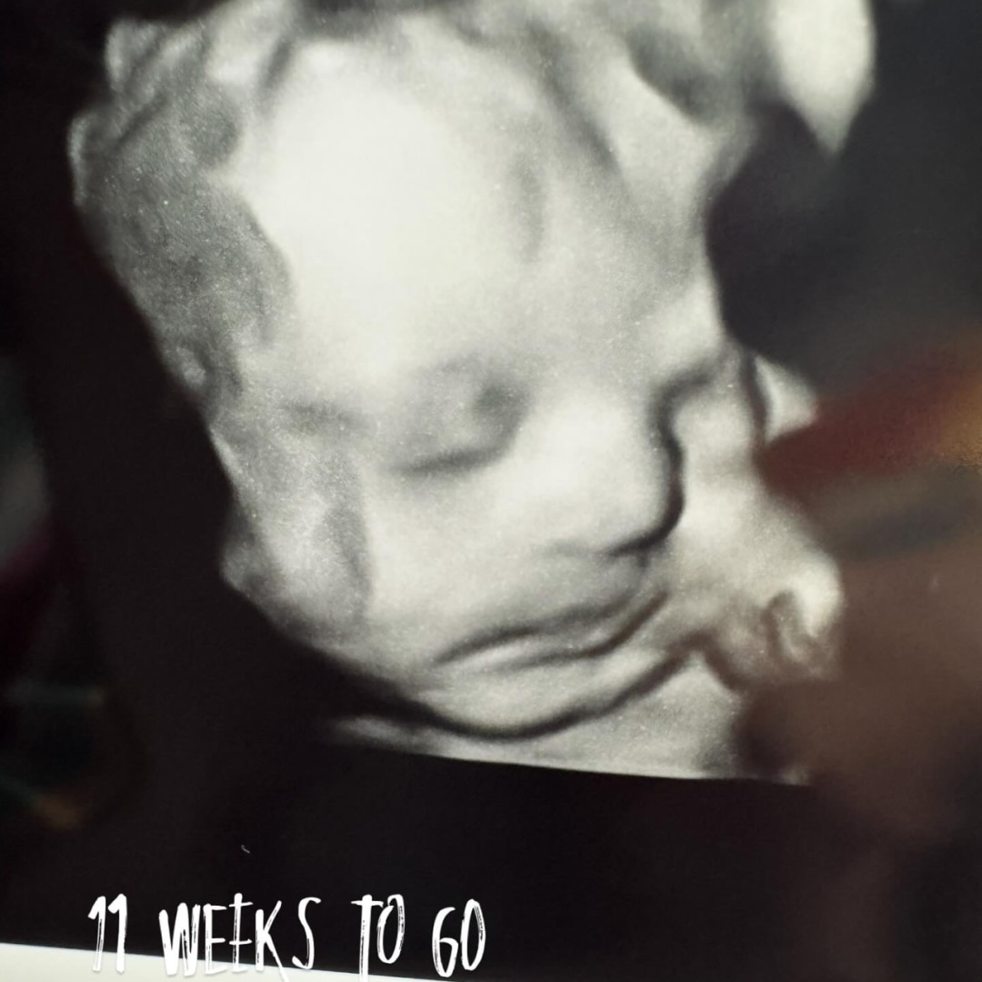 Photo shared by Kelsey for their Babylist baby registry.