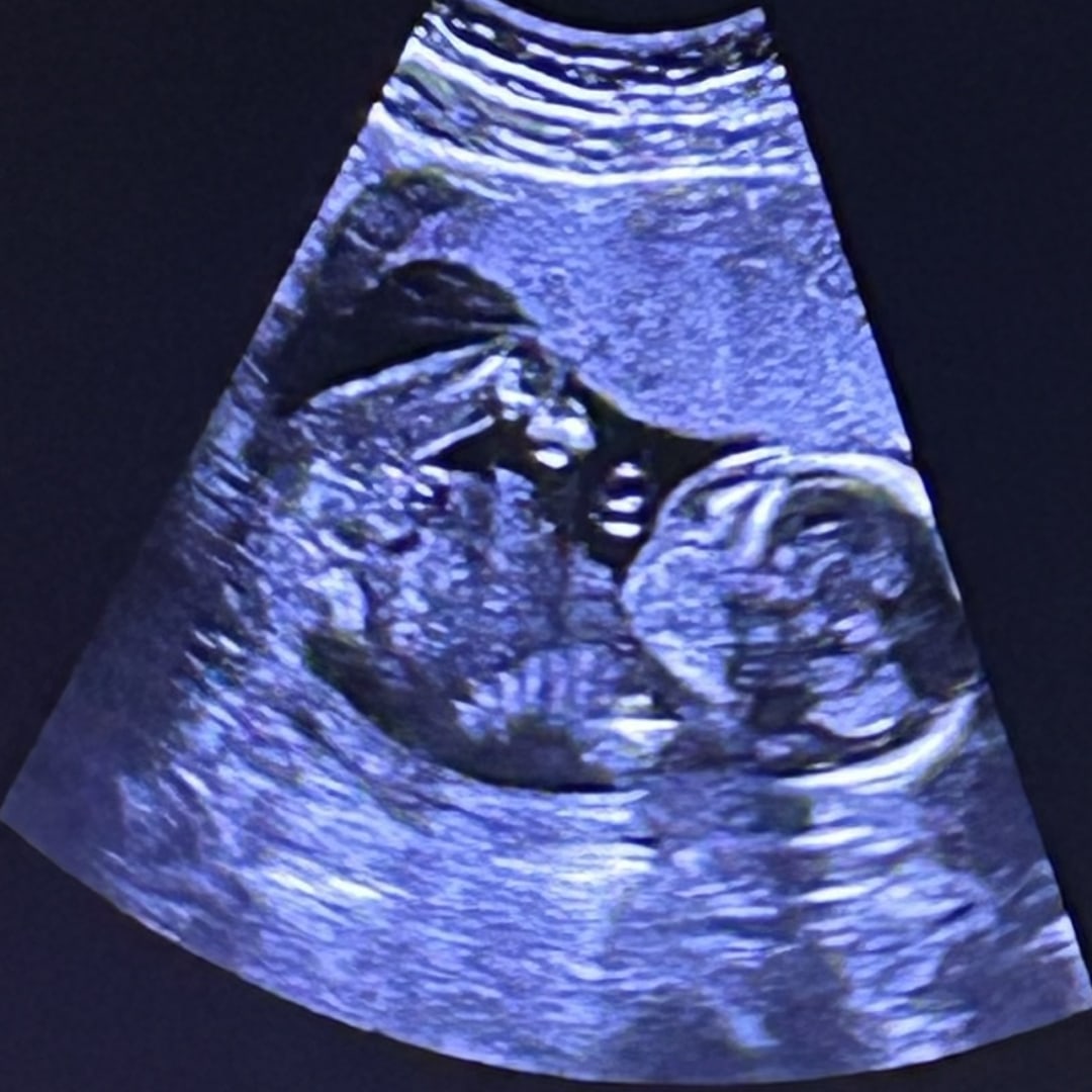 Photo shared by Denise for their Babylist baby registry.