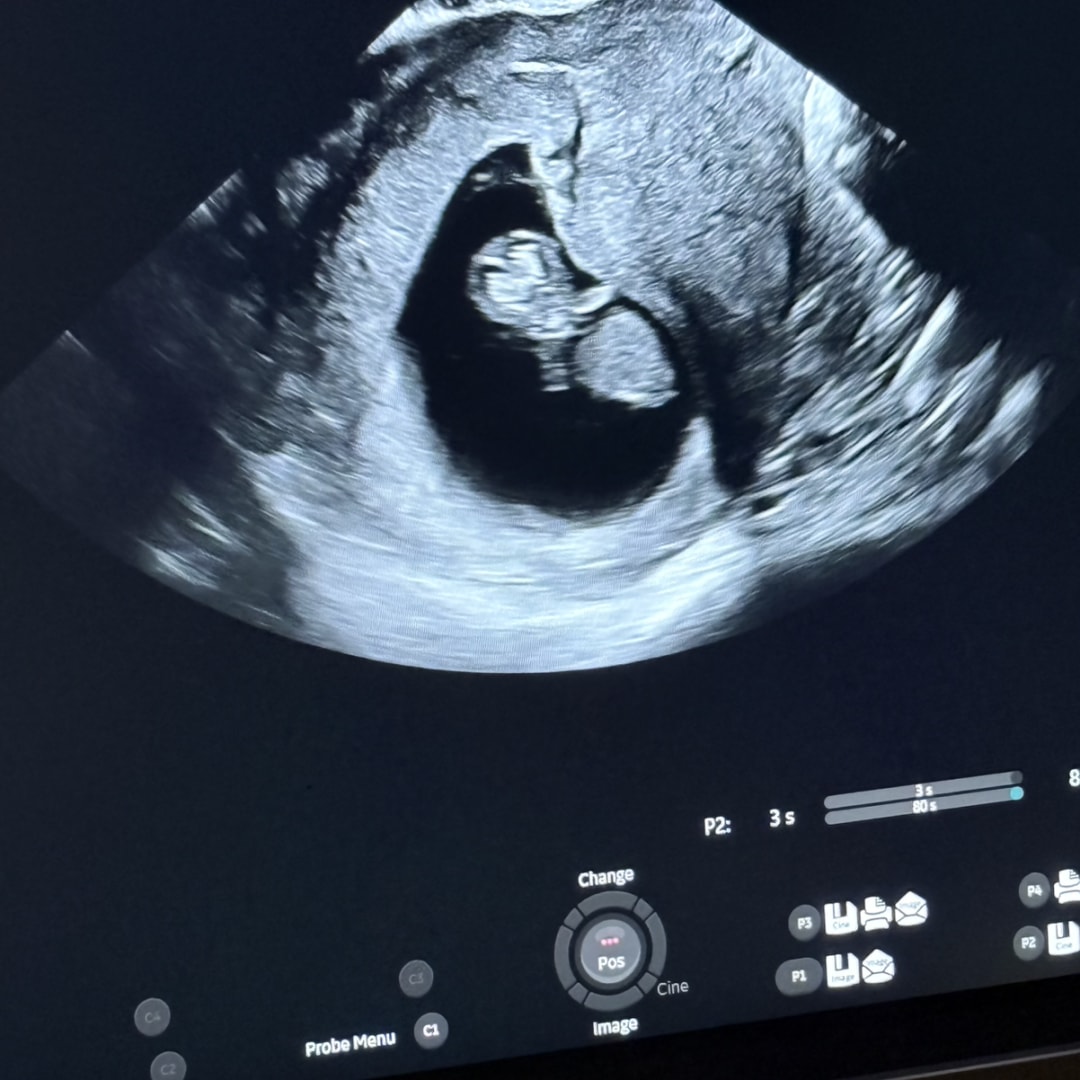 Photo shared by Natalie for their Babylist baby registry.