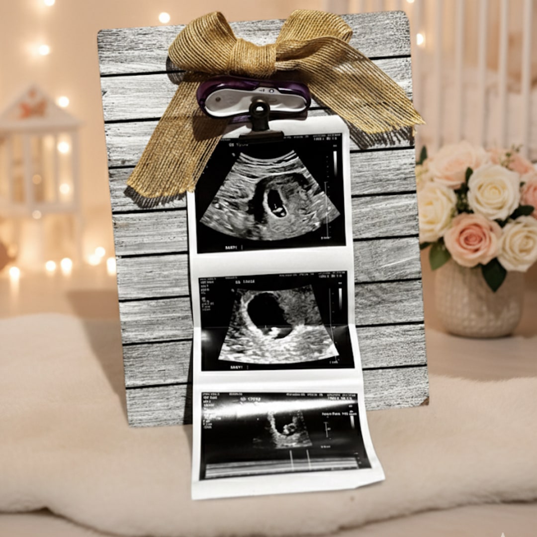 Photo shared by Emily for their Babylist baby registry.