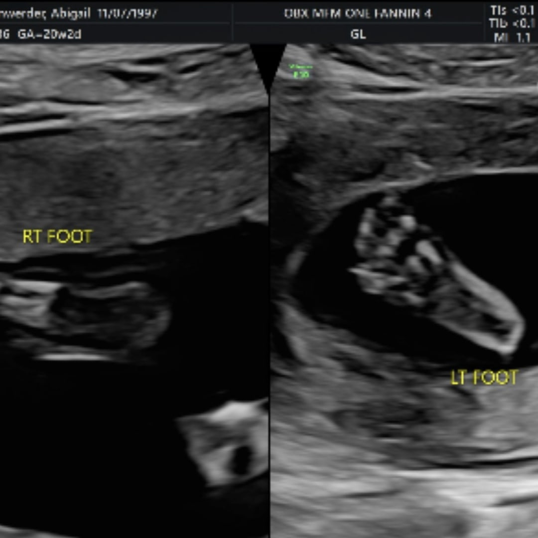 Photo shared by Abigail for their Babylist baby registry.