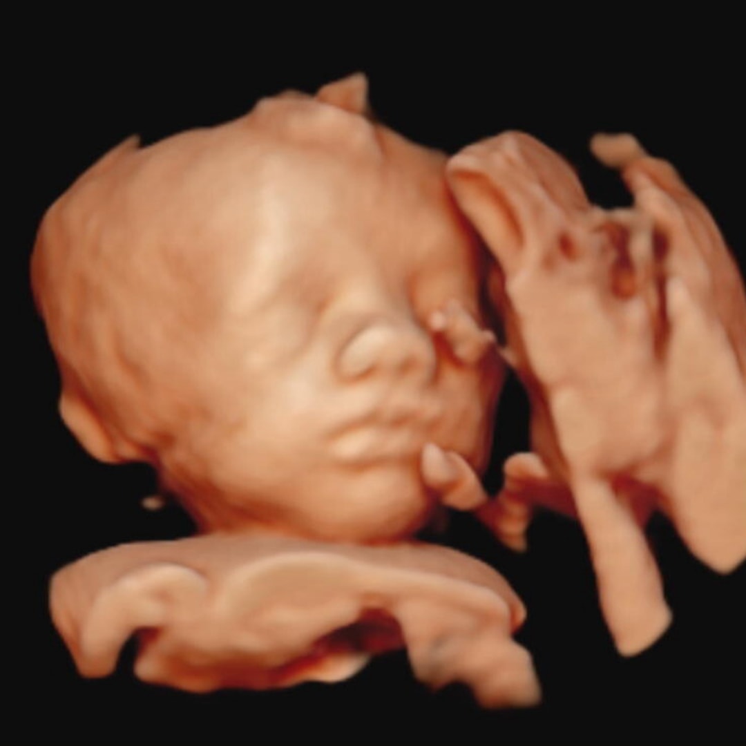 Photo shared by Grace for their Babylist baby registry.