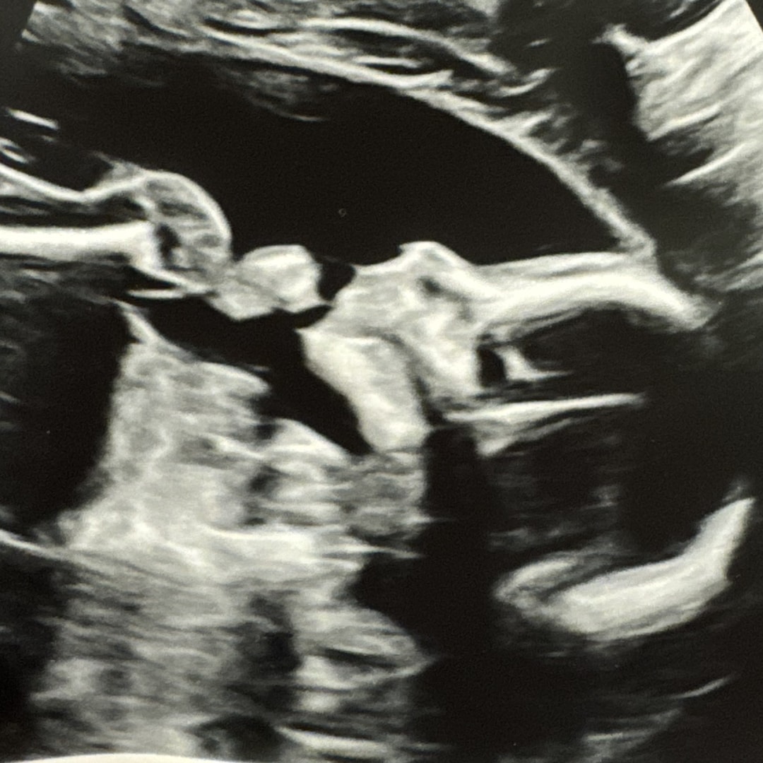 Photo shared by Jaydra for their Babylist baby registry.