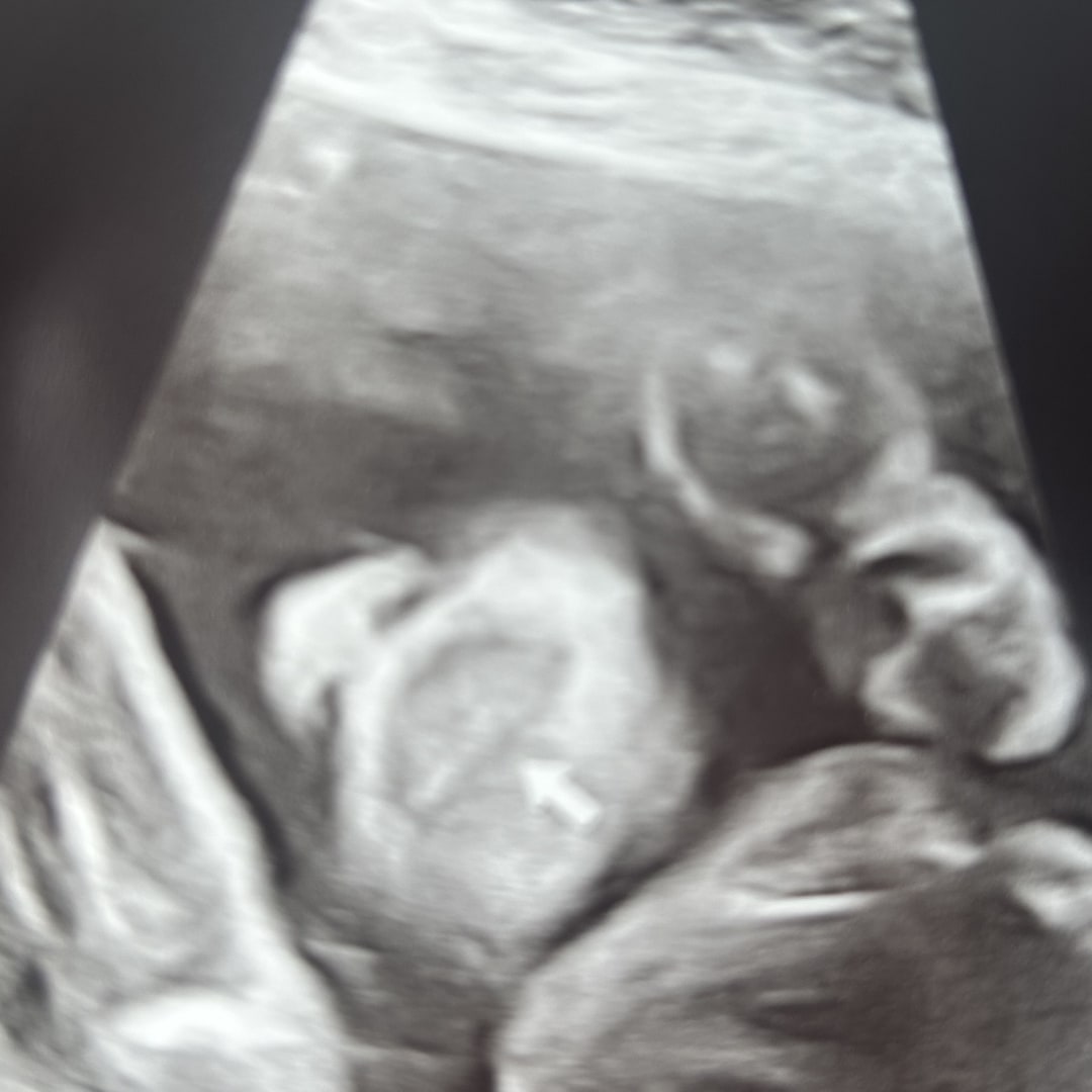 Photo shared by Kimeashia for their Babylist baby registry.