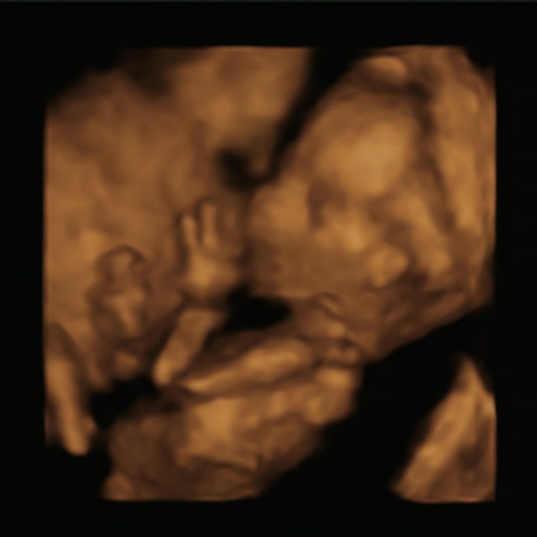 Photo shared by Abby for their Babylist baby registry.
