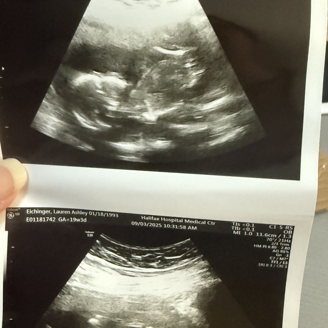 Photo shared by Lauren for their Babylist baby registry.