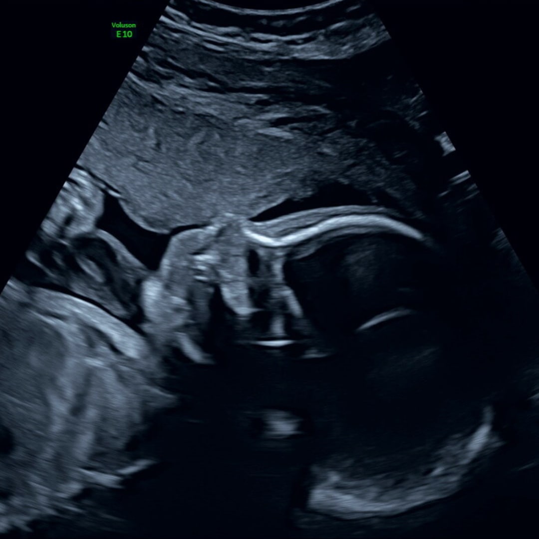 Photo shared by Laura for their Babylist baby registry.