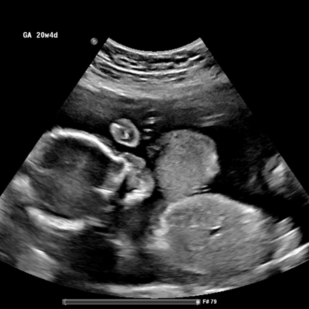 Photo shared by Jaime for their Babylist baby registry.