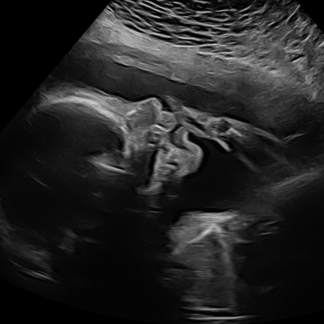 Photo shared by Ally for their Babylist baby registry.