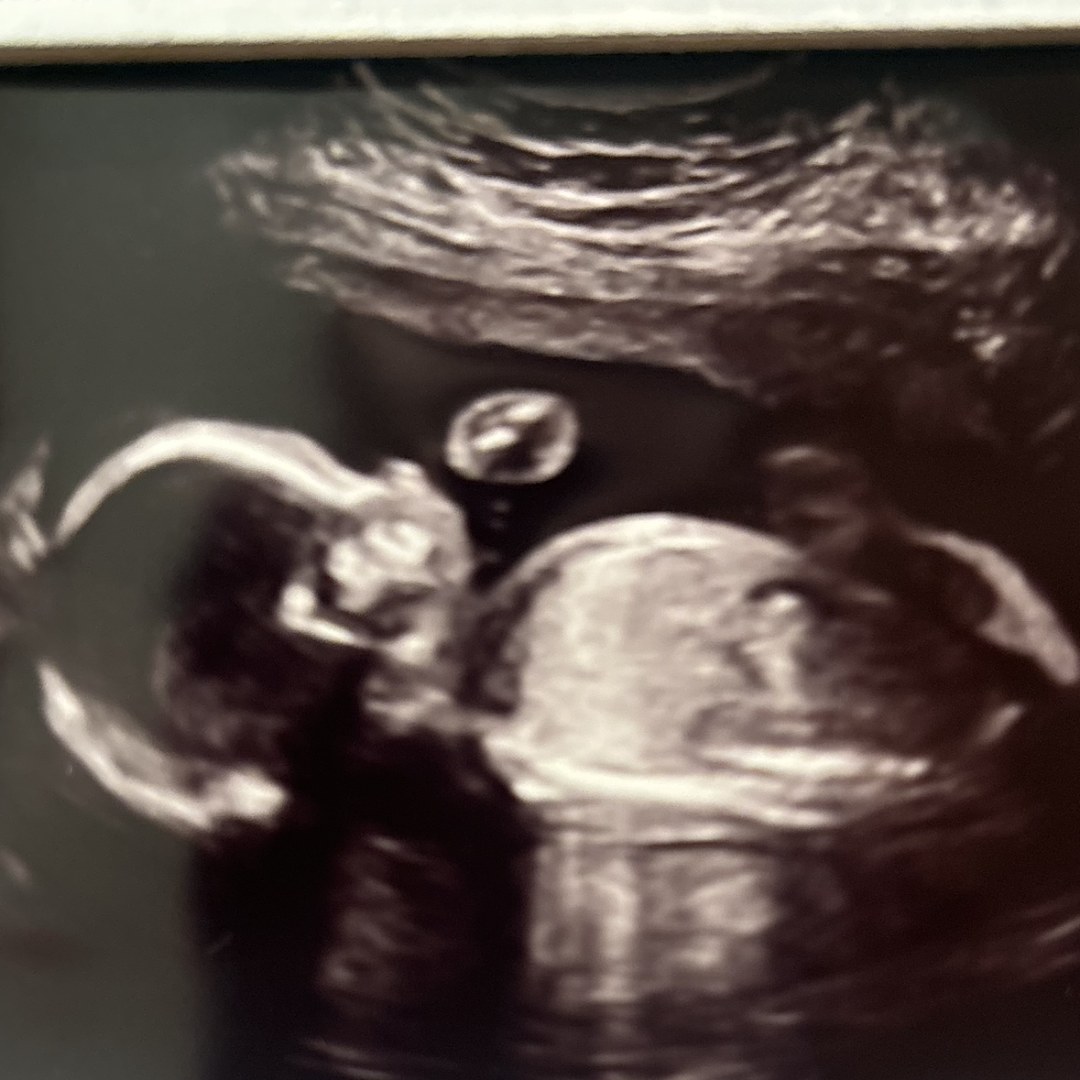 Photo shared by Joan for their Babylist baby registry.