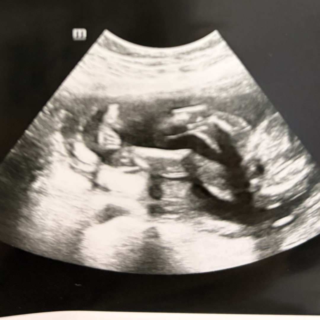 Photo shared by Marisol for their Babylist baby registry.