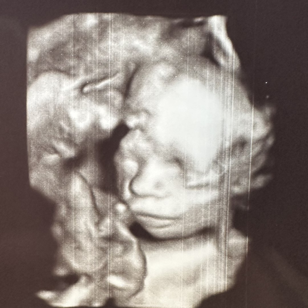 Photo shared by Alexandria for their Babylist baby registry.