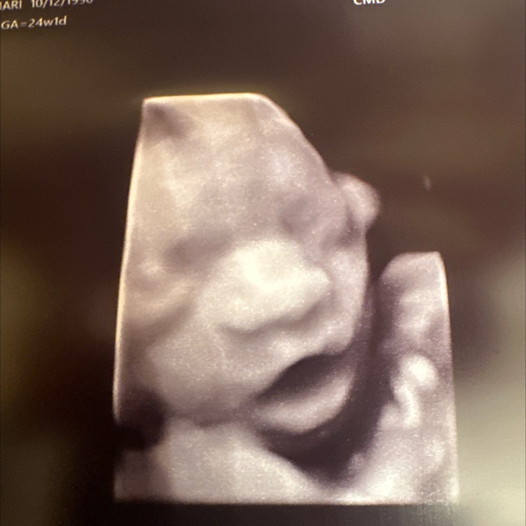 Photo shared by Imari for their Babylist baby registry.