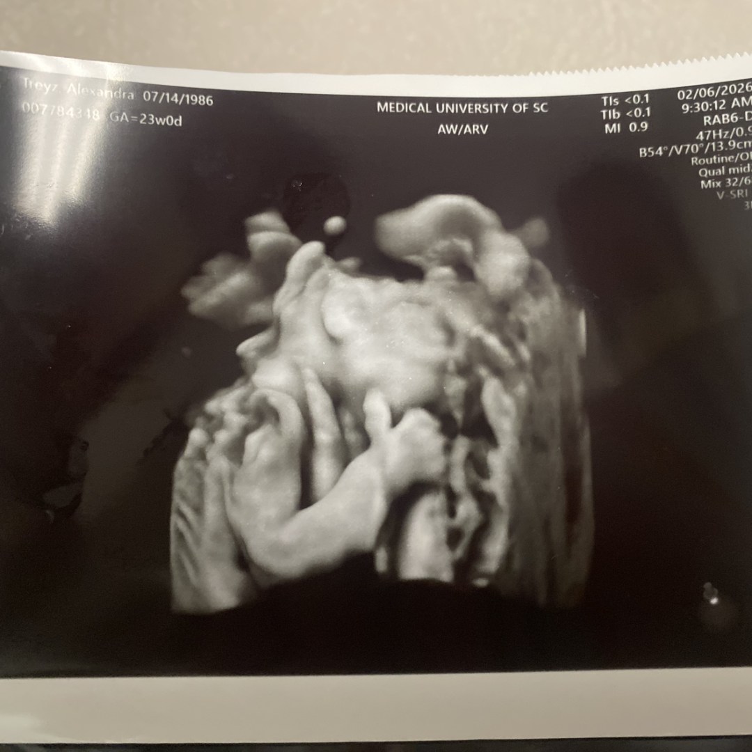 Photo shared by Katie for their Babylist baby registry.