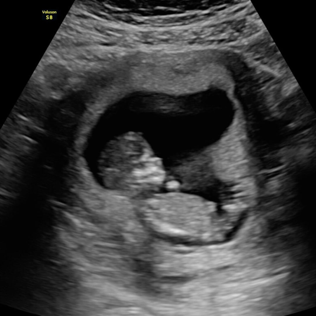 Photo shared by Hannah for their Babylist baby registry.