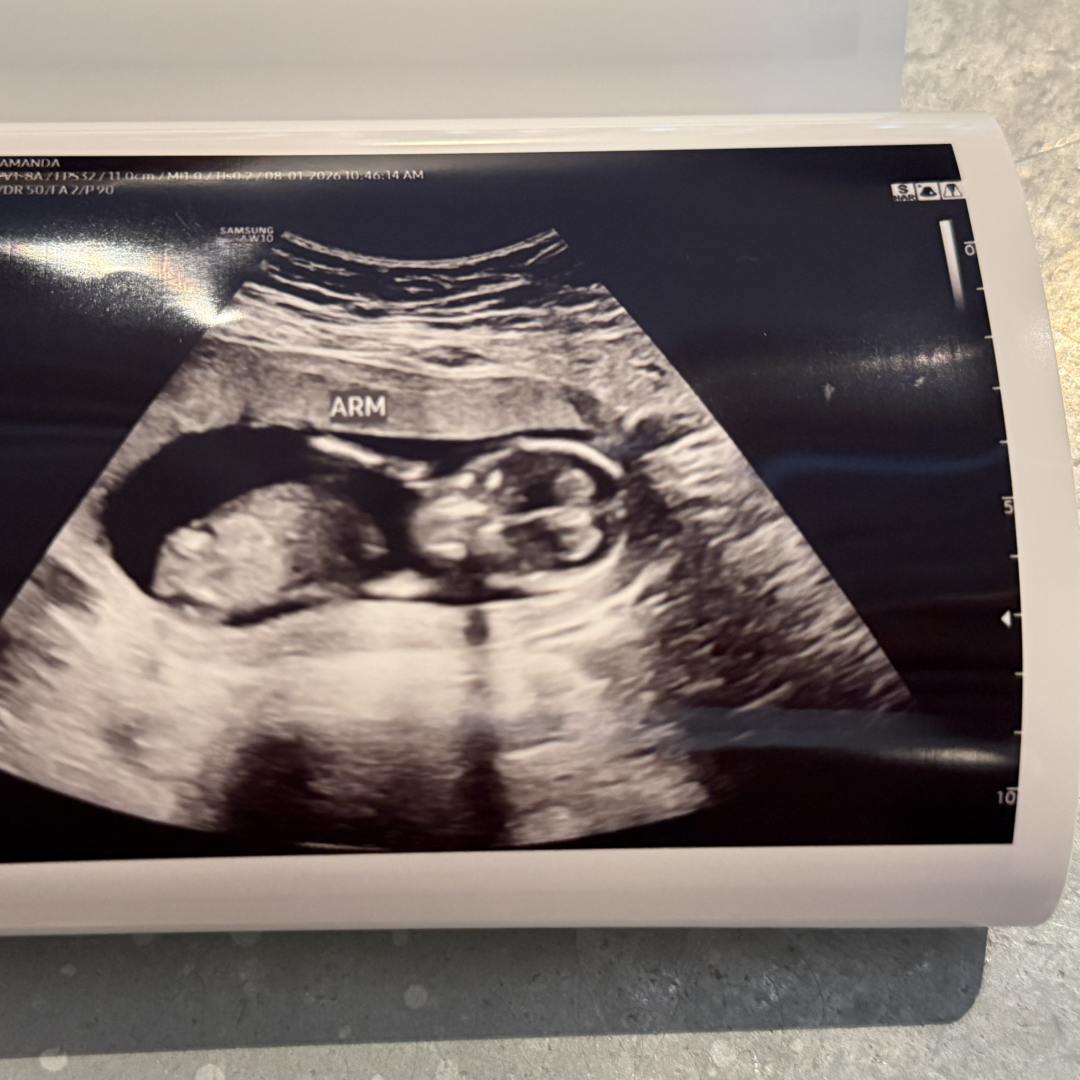 Photo shared by Mandy for their Babylist baby registry.