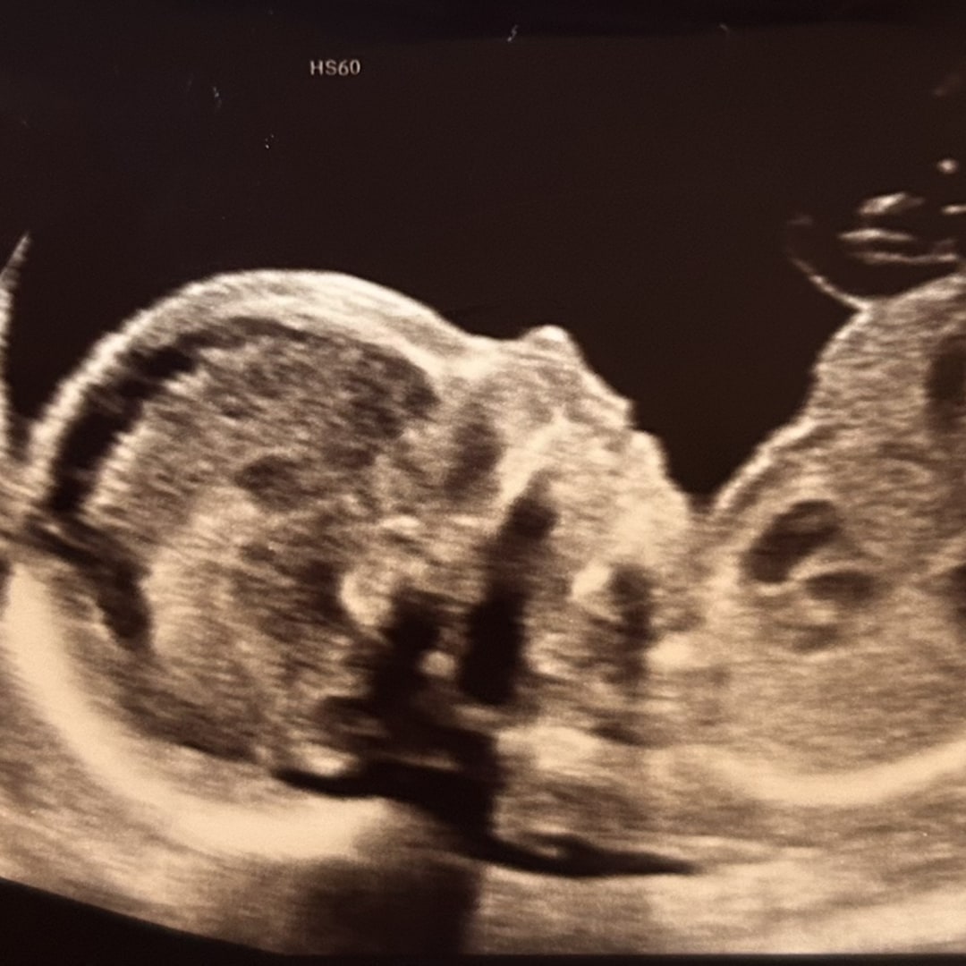 Photo shared by Caitlyn for their Babylist baby registry.