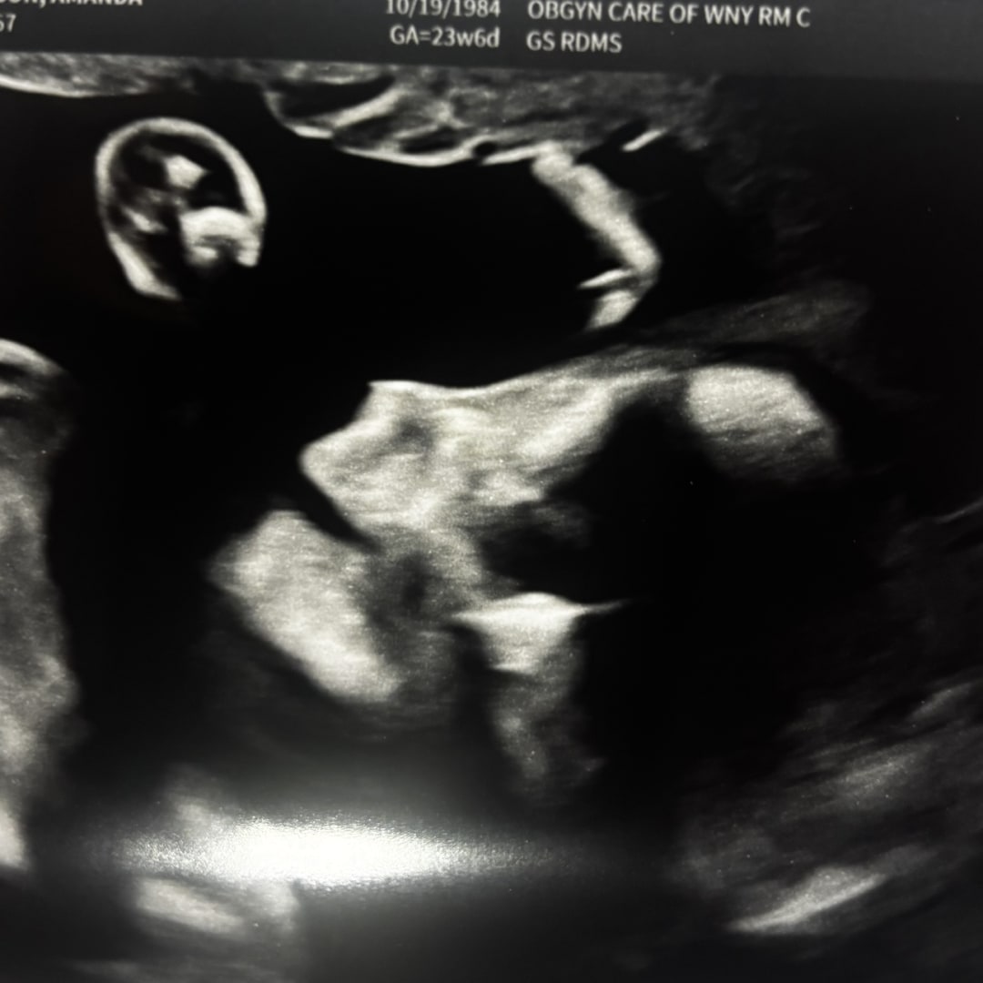 Photo shared by Amanda for their Babylist baby registry.