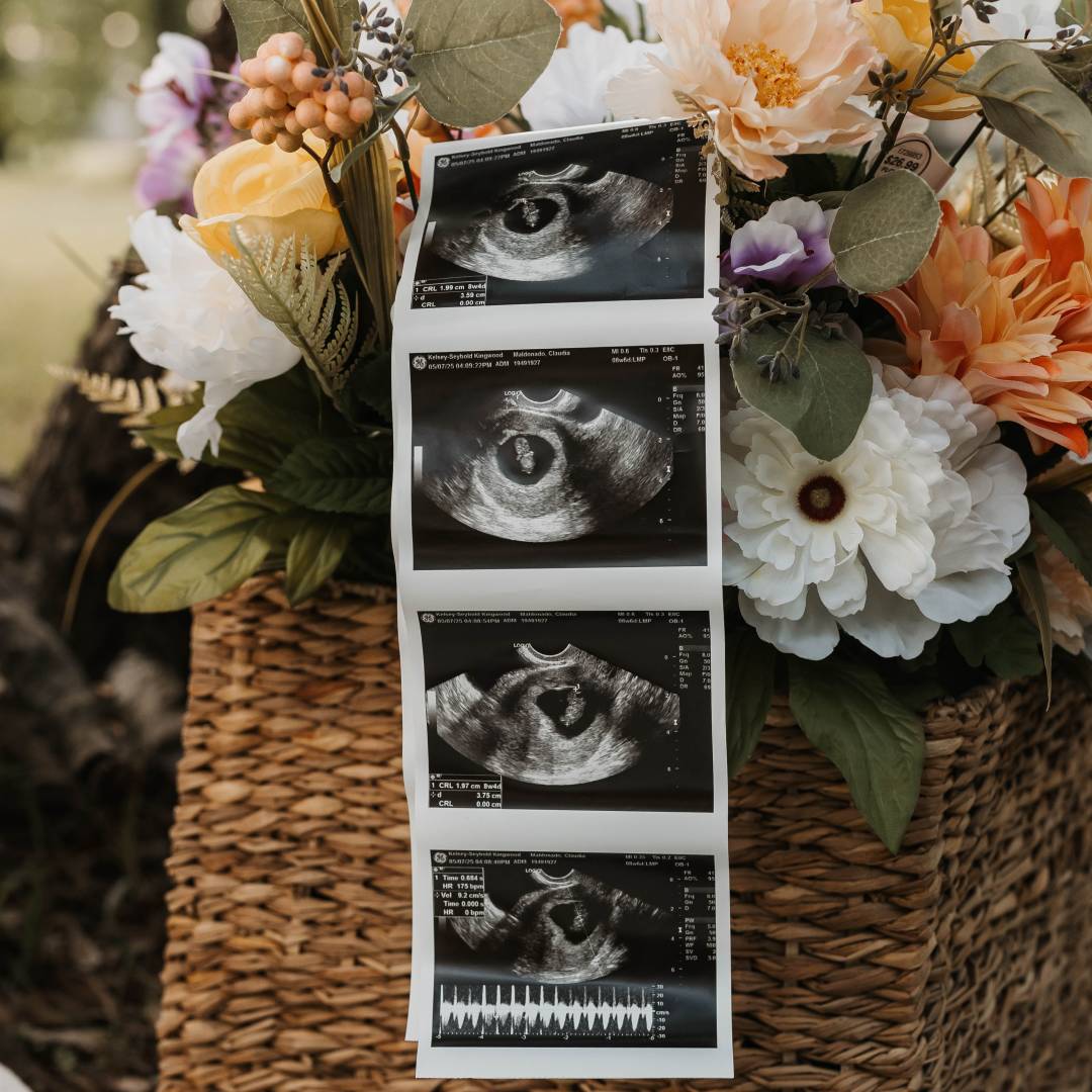 Photo shared by Claudia for their Babylist baby registry.