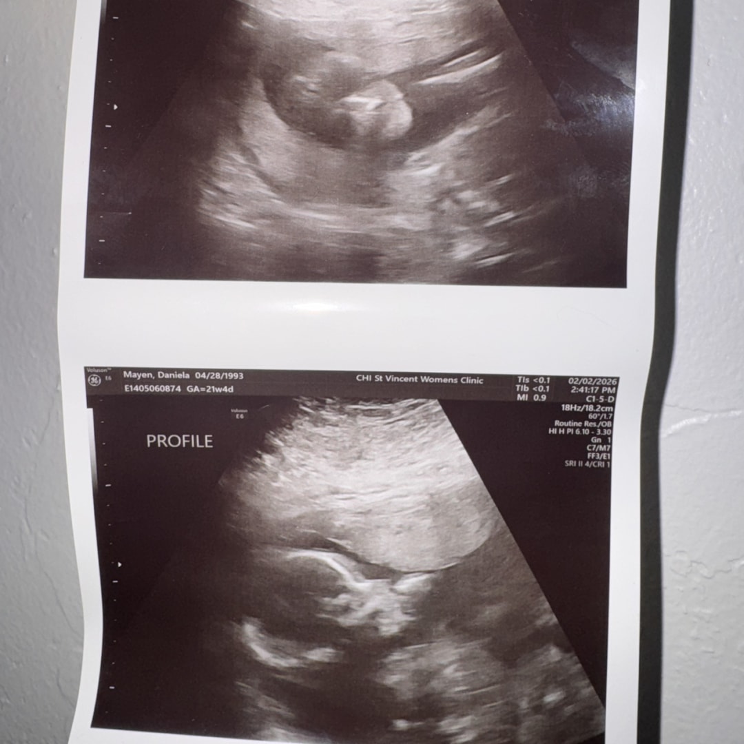 Photo shared by Daniela for their Babylist baby registry.