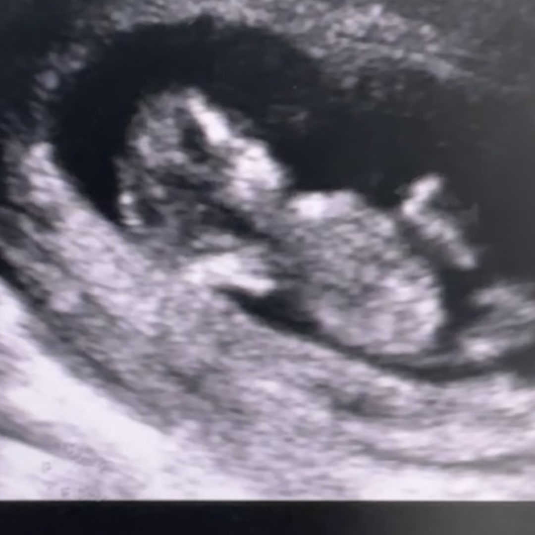 Photo shared by Isabela for their Babylist baby registry.