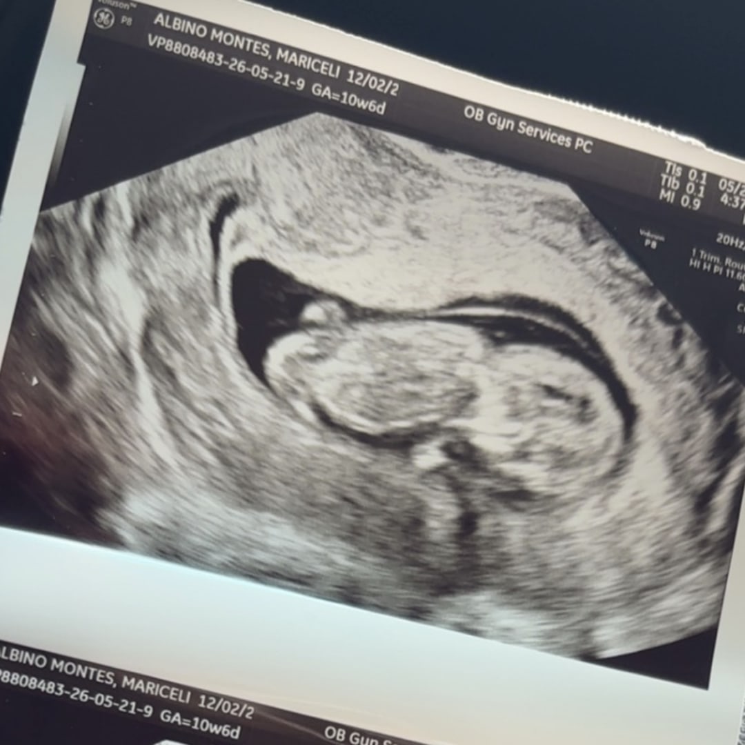 Photo shared by Mariceli Albino for their Babylist baby registry.