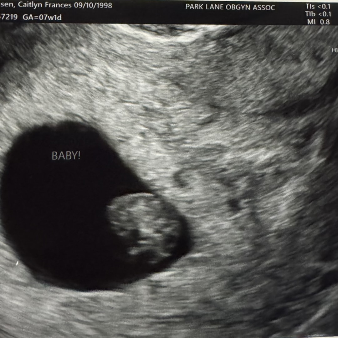 Photo shared by Caitlyn for their Babylist baby registry.