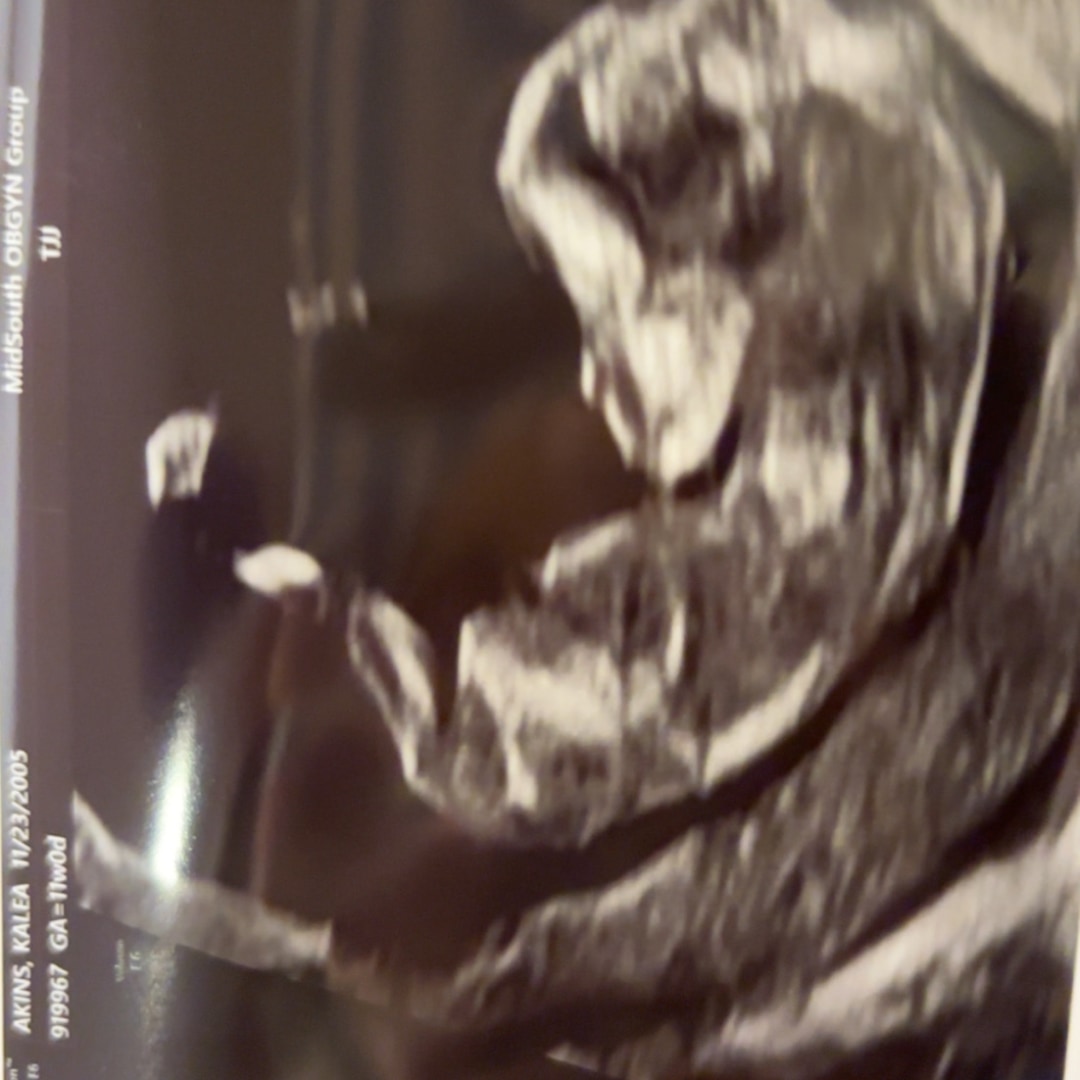 Photo shared by Kalea for their Babylist baby registry.