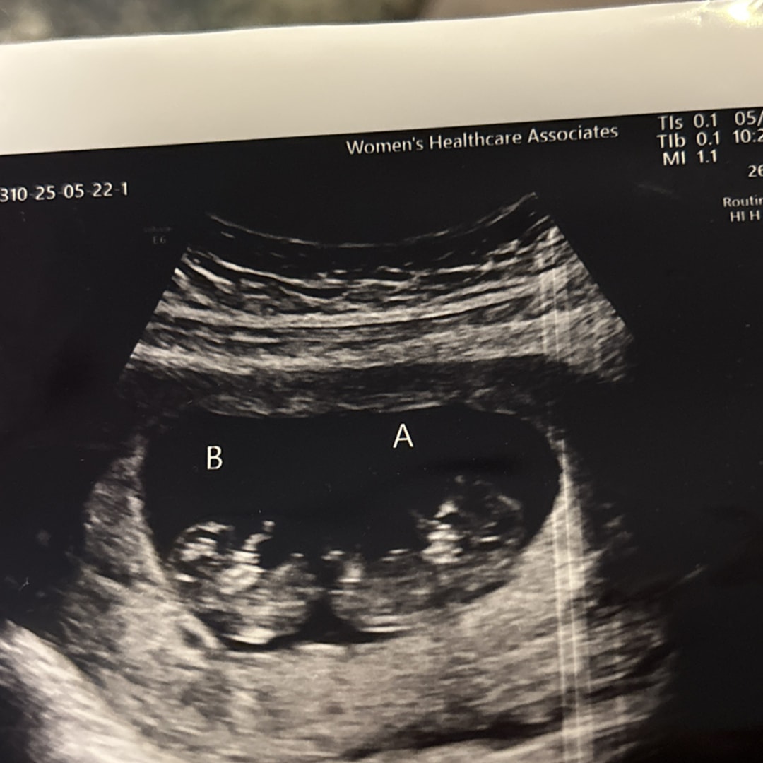 Photo shared by Angela for their Babylist baby registry.