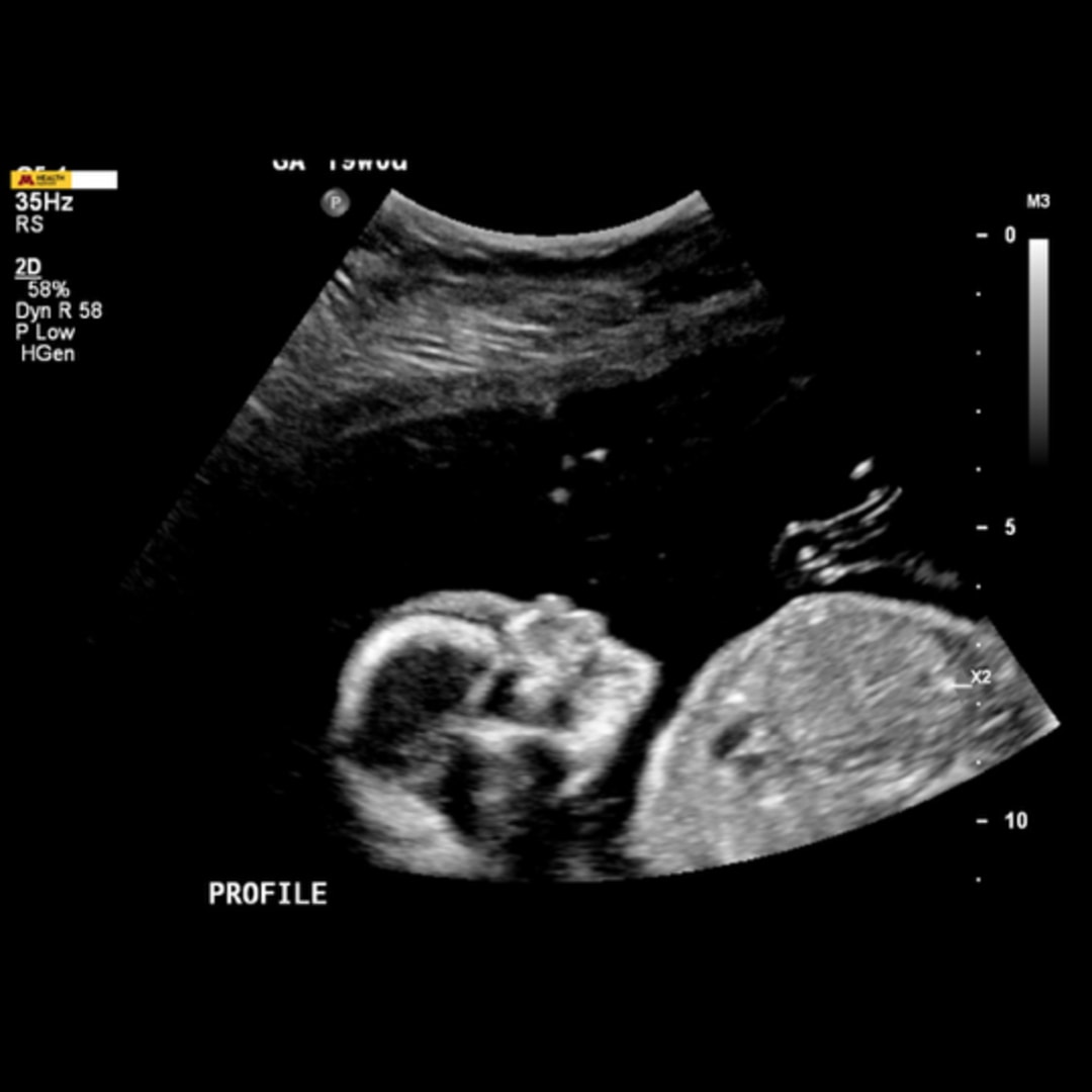 Photo shared by Ellie for their Babylist baby registry.