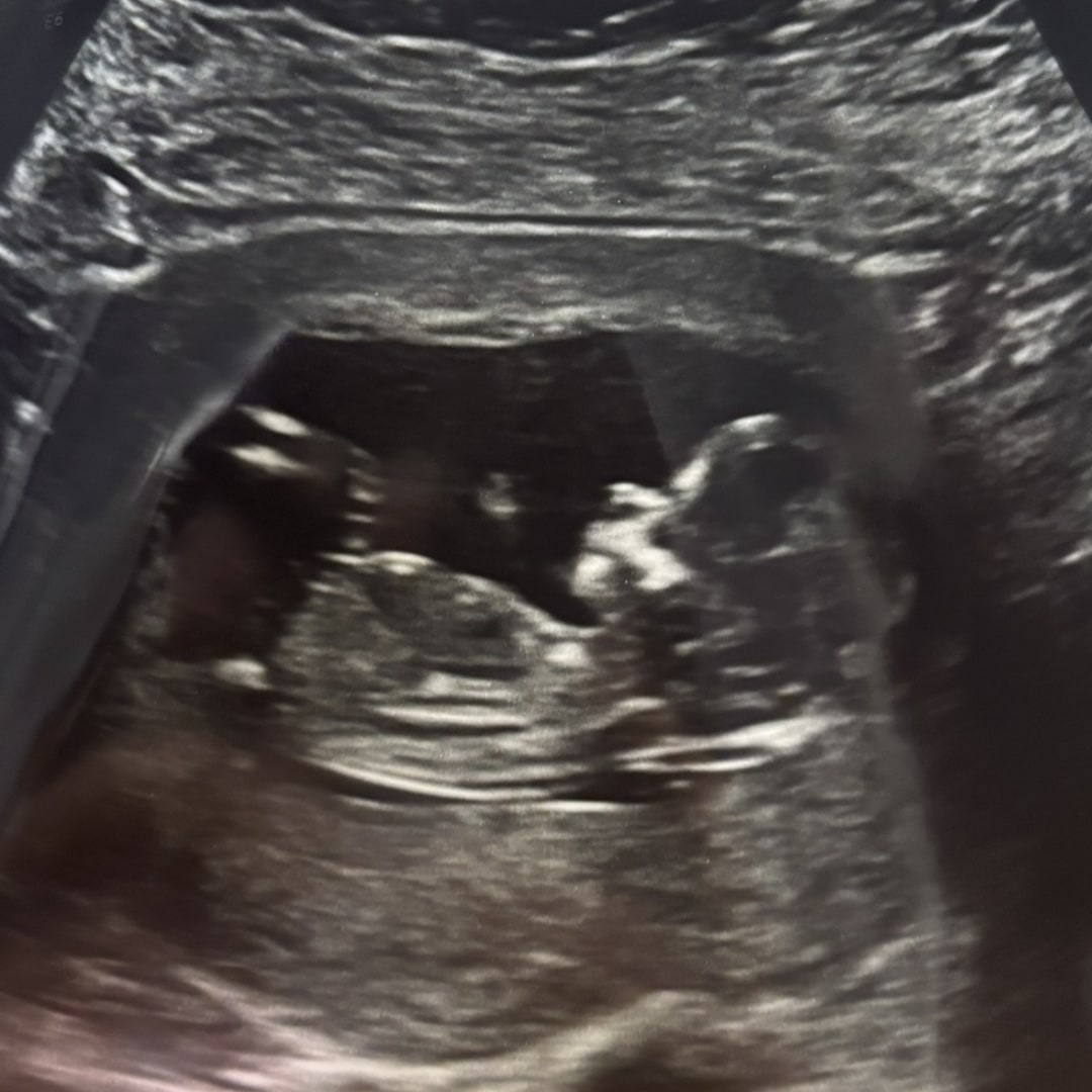 Photo shared by Elizette for their Babylist baby registry.