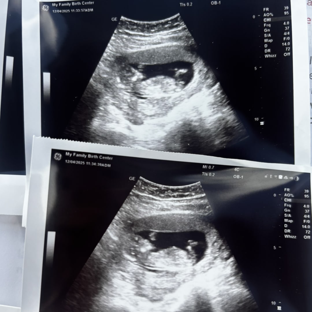 Photo shared by Kaitlynn for their Babylist baby registry.