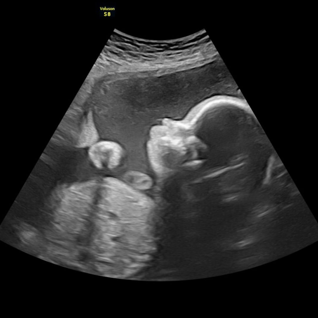 Photo shared by Shelby for their Babylist baby registry.