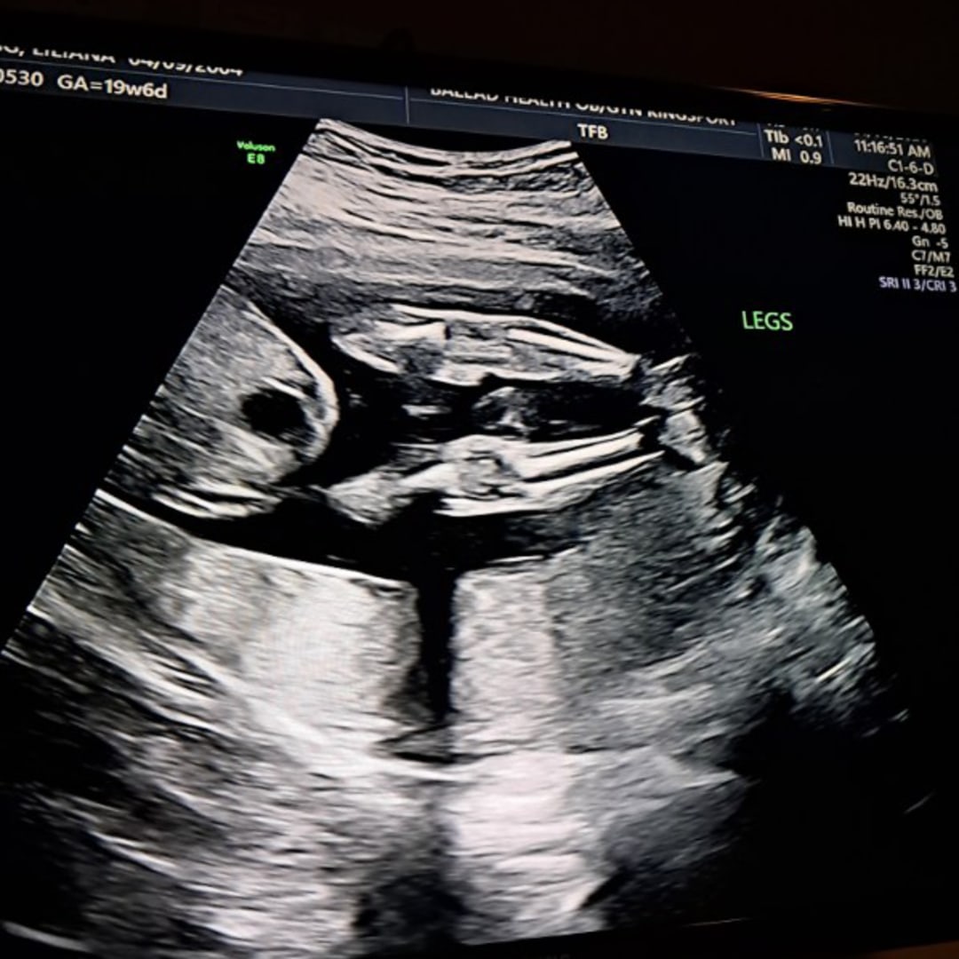 Photo shared by Liliana for their Babylist baby registry.