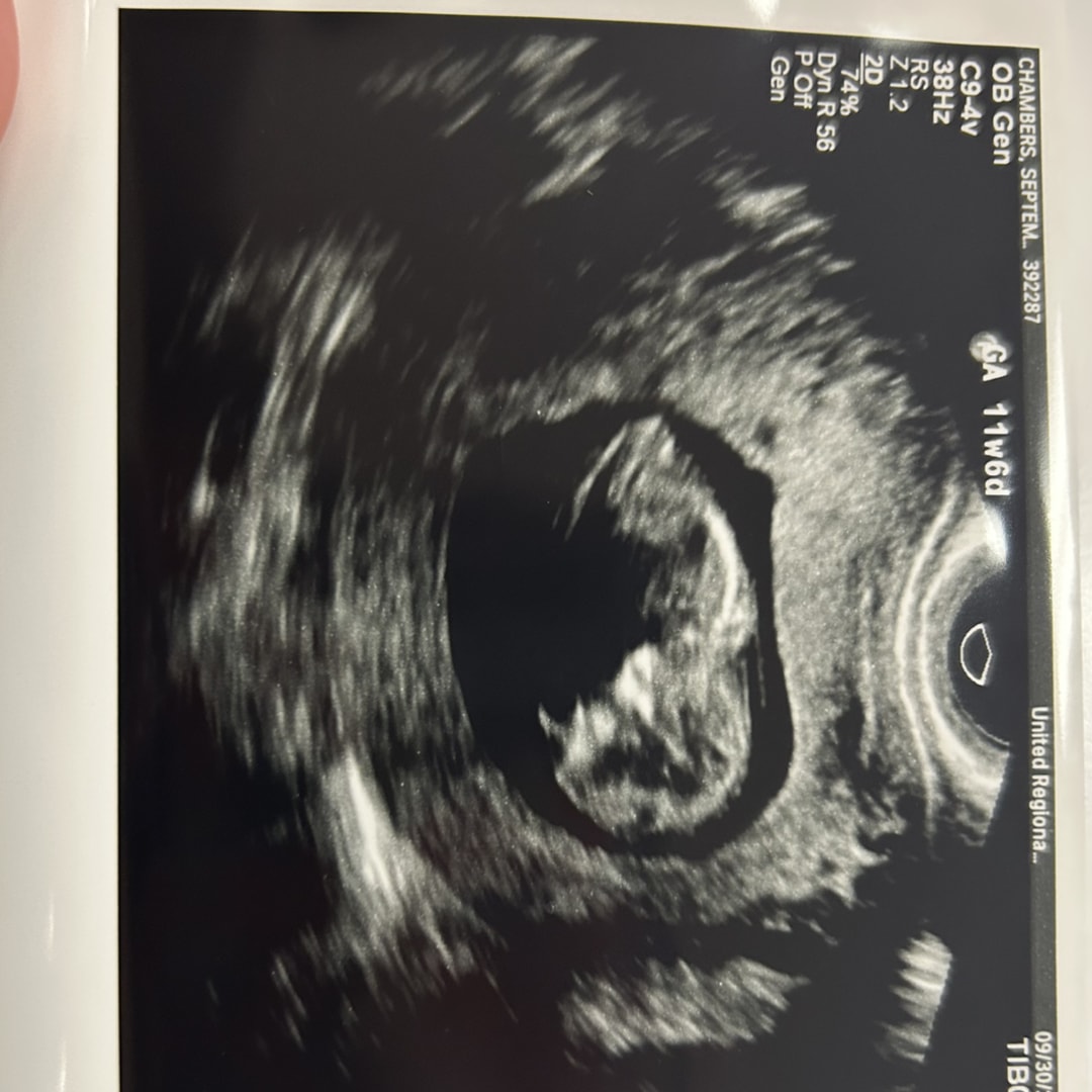 Photo shared by September for their Babylist baby registry.